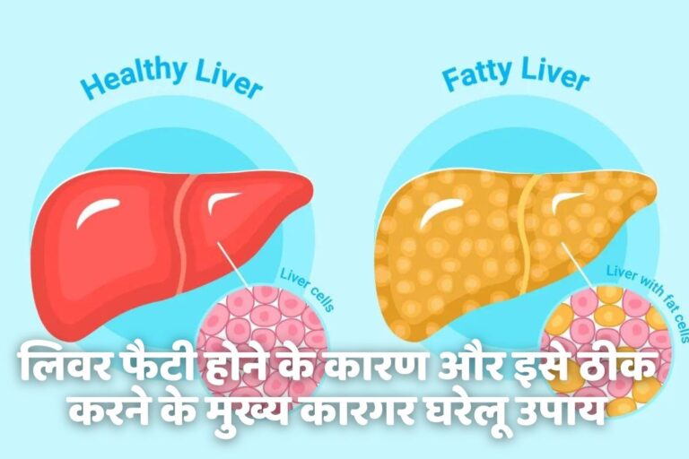 fatty-liver-ke-gharelu-upay